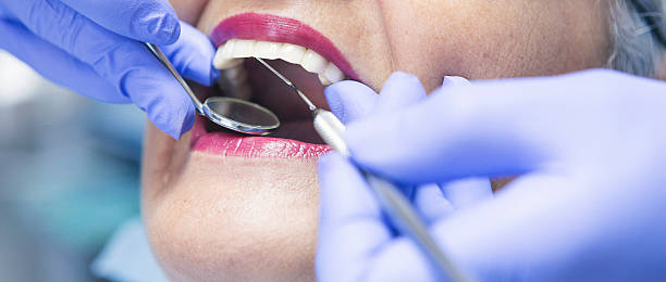 Best Emergency Root Canal Treatment in West Wyomissing, PA